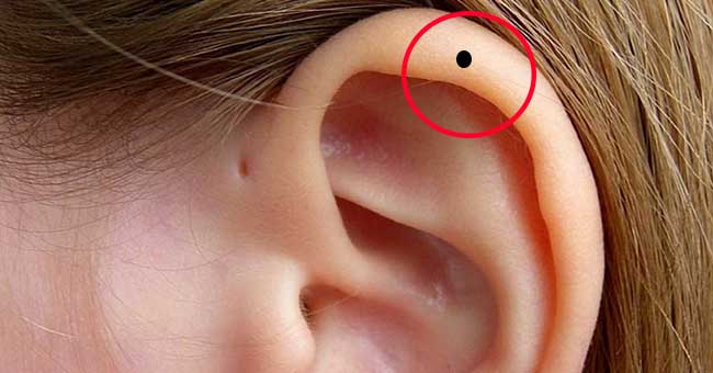 6 vị trí nốt ruồi ở tai quý hơn vàng. Giải mã ý nghĩa nốt ruồi ở tai