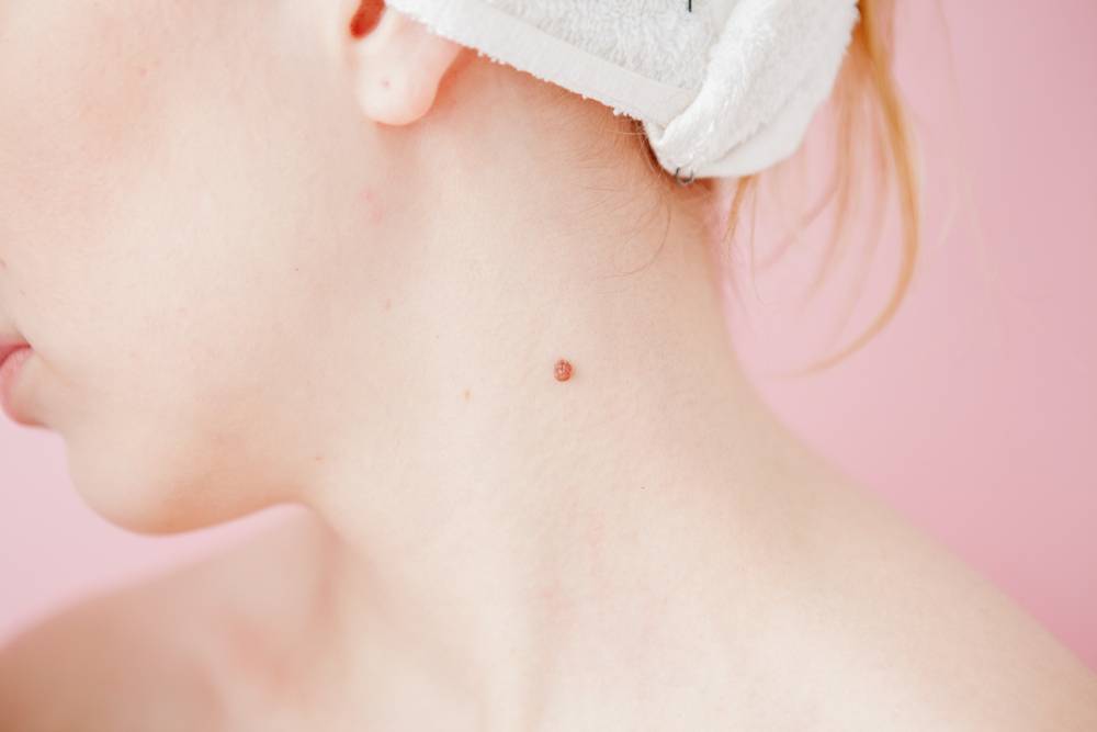 7 vị trí nốt ruồi ở cổ báo hiệu may mắn, tiền tiêu cả đời không hết