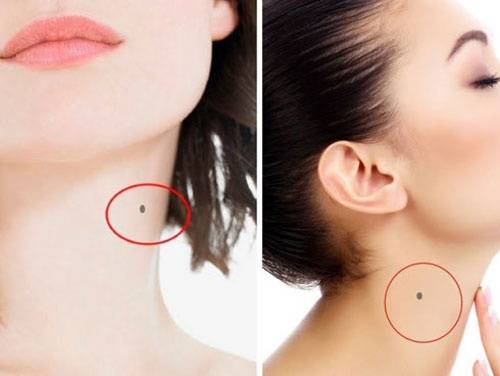 7 vị trí nốt ruồi ở cổ báo hiệu may mắn, tiền tiêu cả đời không hết 10 Nốt ruồi ở cổ phụ nữ, nữ giới