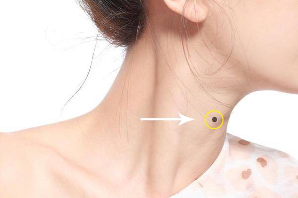 7 vị trí nốt ruồi ở cổ báo hiệu may mắn, tiền tiêu cả đời không hết 14 Có nên tẩy nốt ruồi ở cổ không?