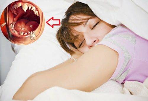 Giải mã việc nằm mơ thấy rụng răng chính xác 100% 6 Trong khi mơ rụng hết cả hàm răng là điềm báo gì trong cuộc sống?