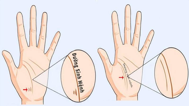 Những đường chỉ tay xấu dự báo số phận lận đận, gian truân 6 Đường sinh mệnh bị đứt đoạn biểu thị sức khỏe không tốt