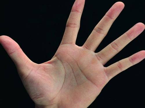 Những đường chỉ tay xấu dự báo số phận lận đận, gian truân 7 Những đường chỉ tay xấu, không tốt