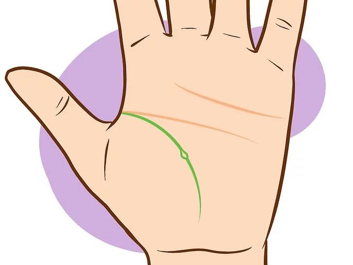 Tiên đoán tương lai qua 4 đường chỉ tay nam giới cực chuẩn 9 Nếu đường sinh đạo có vòng tròn nhỏ nằm trên đường sinh đạo – Mẩu người sẽ phải nhập viện hoặc bị thương