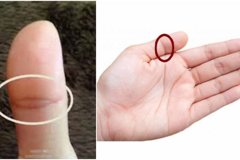 Tiên đoán vận mệnh của đường chỉ tay đuôi phượng chuẩn 100% 11 Người có vân mắt phượng ở ngón cái