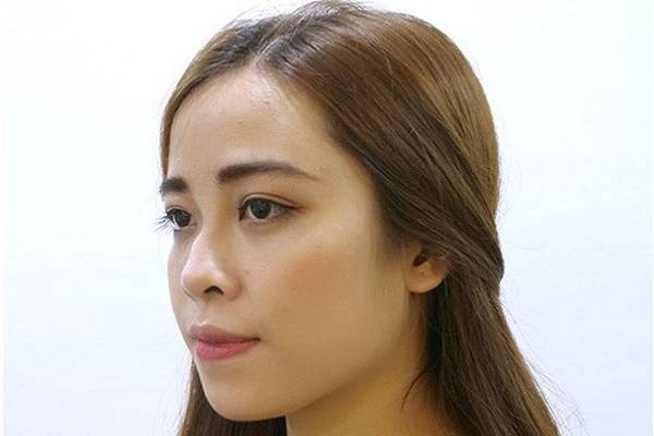Vận mệnh của tướng mũi gãy như thế nào? Tốt hay xấu? 9 Phụ nữ tướng mũi gãy có ý nghĩa gì?